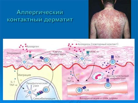 Аллергические реакции и покраснение