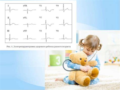 Важность исследования электрокардиограммы у детей в клиниках Перми