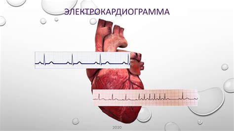 Важность своевременной коррекции аномального сердечного ритма у маленьких пациентов