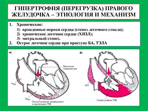 Ведущие клинические проявления гипокинезии миокарда левого желудочка: