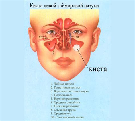 Верхнечелюстная пазуха и ее функции