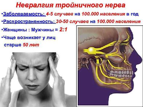 Ветвистость тройничного нерва: сколько ответвлений?