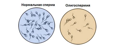 Взаимосвязь повышенной температуры и качества семенной жидкости у мужчин