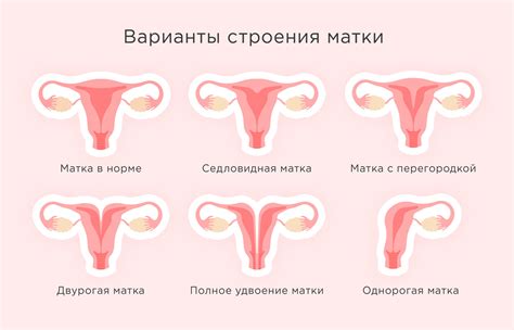 Виды операций по гистерэктомии матки