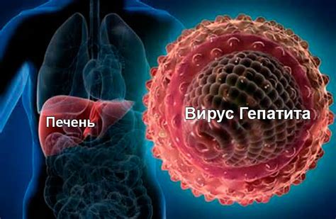 Вирусные гепатиты