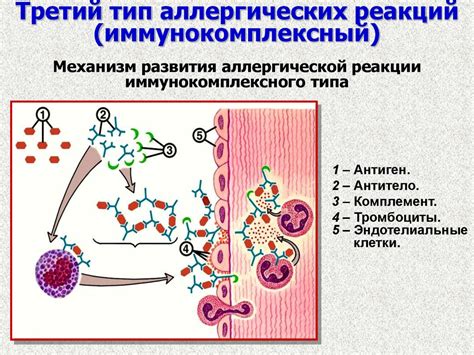 Влияние аллергических реакций на ощущение жжения в правой половине лица