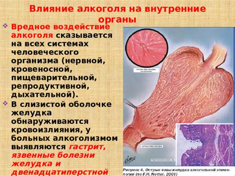 Влияние гетеротопии слизистой желудка на организм