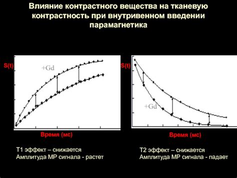 Влияние дозировки контрастного вещества на качество образов во время проведения КТ-исследования