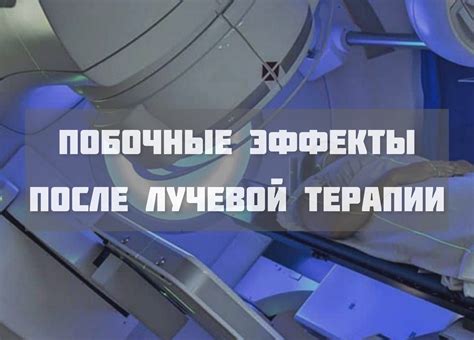 Влияние лучевой терапии на развитие опухоли