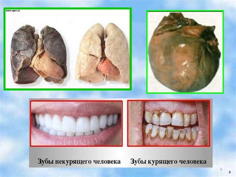 Влияние пагубных привычек на здоровье и состояние кожи