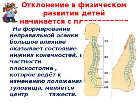 Влияние плоскостопия на состояние нижних конечностей