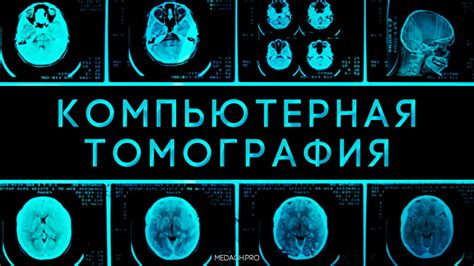 Влияние рискоположений на принятие решения о посещении компьютерной томографии