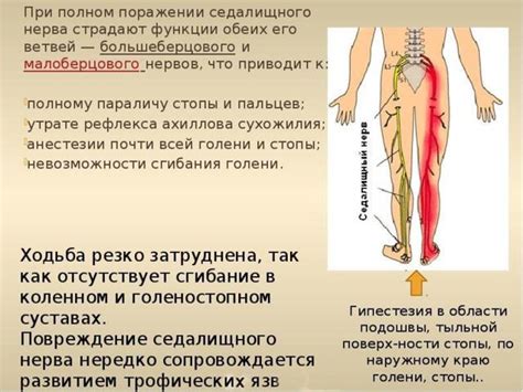 Влияние седалищного нерва на организм женщины: причины и следствия