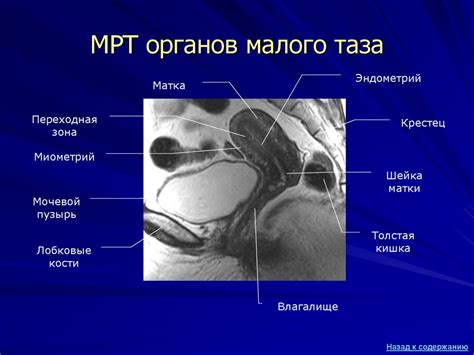 Влияние седалищного нерва на функционирование органов малого таза у женщин