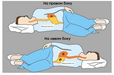 Влияние типа поверхности на качество сна при проблемах с позвоночником