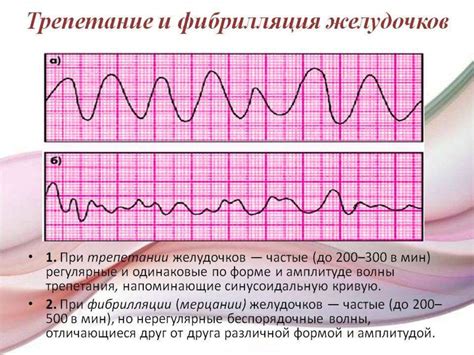 Влияние увеличенного сердечного ритма на общую физическую и психическую нагрузку организма