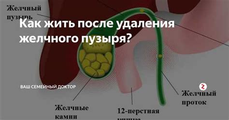 Влияние удаления желчного пузыря на проведение колоноскопии: преимущества и недостатки