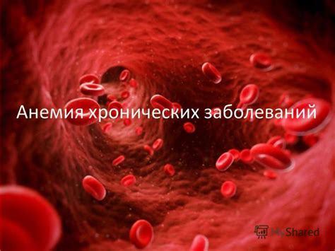 Влияние хронических заболеваний на уровень содержания гемоглобина