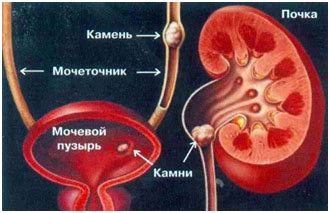 Внутренние факторы: красные покрытия как сигнал о возможных заболеваниях