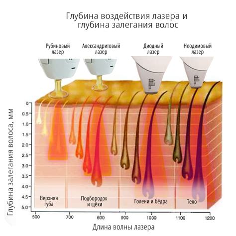 Возможное взаимодействие волос и процесса лазерной эпиляции