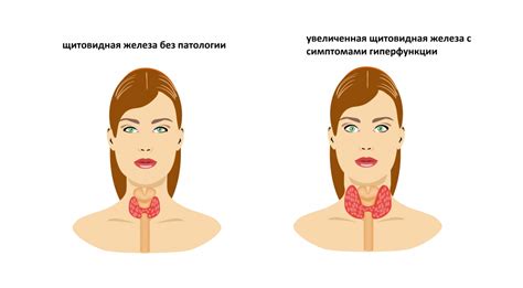 Возможные отклонения показателей ТТГ гормона при поздней приеме пищи