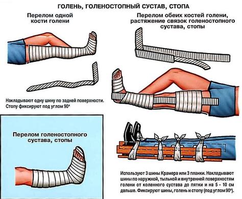 Возможные последствия извлечения орудия проникновения при ранении