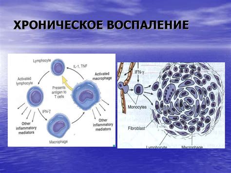 Воспаление и его роль в изменении температуры организма: ключевая связь