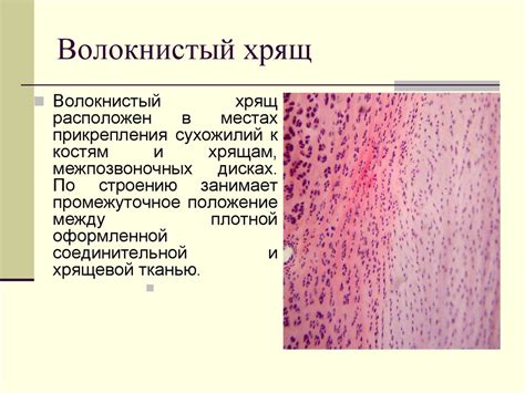 Где еще можно обнаружить прозрачный хрящ в организме: необычные местоположения