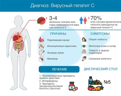 Геза вайз: причины, симптомы, лечение и профилактика