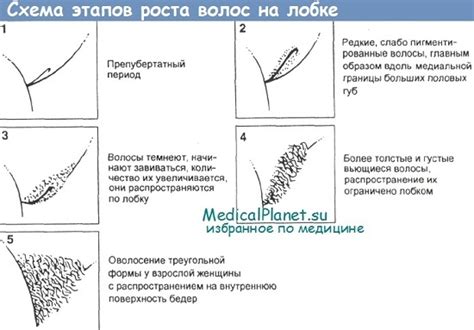 Генетическая природа отсутствия волос на лобке