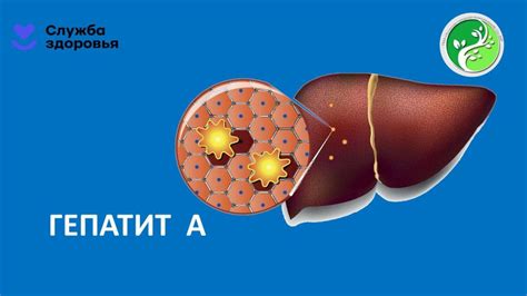 Гепатит В – это инфекционное заболевание печени, вызванное вирусом гепатита В.