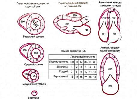 Гипокинезия миокарда левого желудочка: