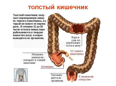 Гипомоторная дискинезия толстого кишечника