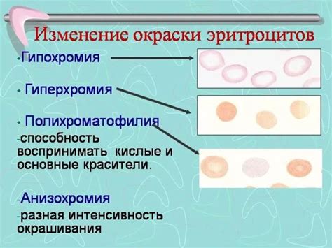 Гипохромия эритроцитов у ребенка: