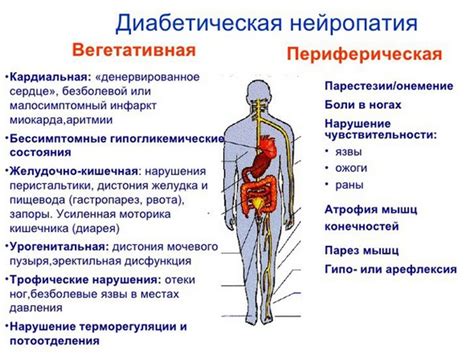 Диабетическая нейропатия: симптомы, на которые необходимо обратить внимание