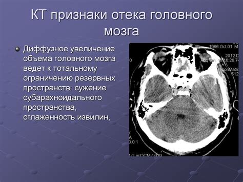 Диагностика герпеса головного мозга