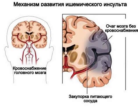 Диагностика гипоксии мозга у новорожденных