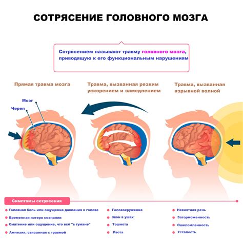 Диагностика и лечение отклонений в положении главных структур головного мозга