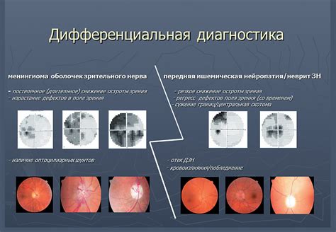 Диагностика и лечение расстройств зрения после потрясения головного мозга