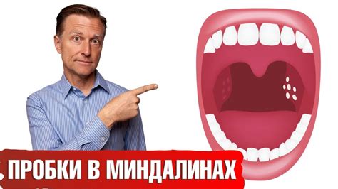 Диагностика паразитических организмов и связь с неприятным ощущением дискомфорта в горле