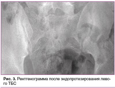 Диагностика сжатия позвонков: выявление нарушений позвоночной структуры