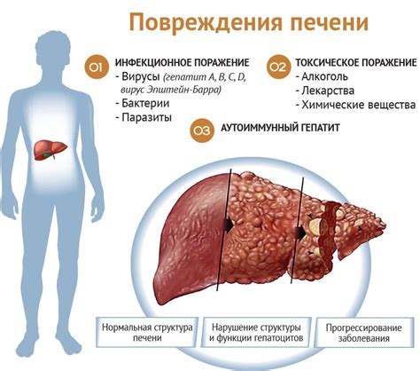 Заболевания печени и их причины