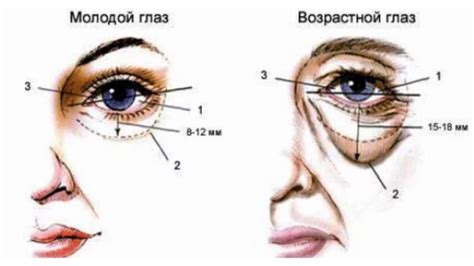 Изменения, связанные с возрастом, в области вокруг глаз