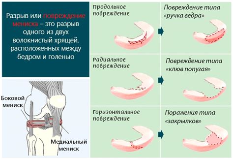 Изменения коленного сустава у младенцев: основные процессы