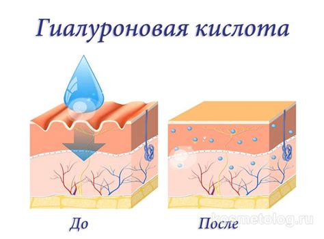 Использование гиалуроновой кислоты в медицине