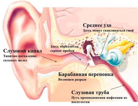 Исследования: воздействие применения гарнитур на время заживления воспаления среднего уха