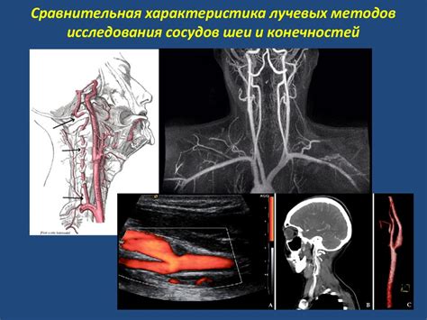 Исследования высокого качества: сокращенный обзор надежных центров для точного ультразвукового исследования сосудов шеи