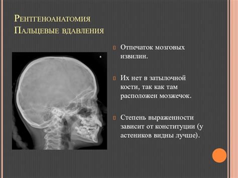 Какие МР-проявления указывают на наличие внутричерепной гипертензии?