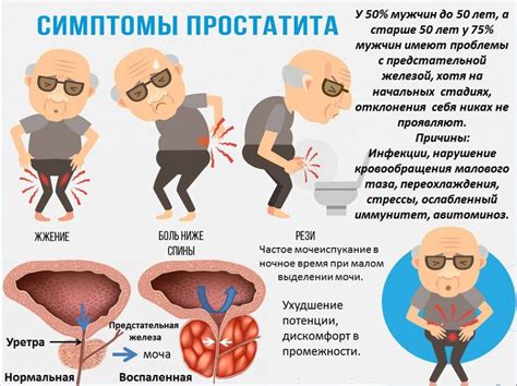 Какие симптомы могут быть связаны с гипоэхогенным участком в предстательной железе?