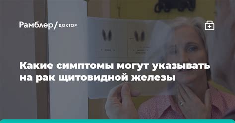 Какие симптомы могут указывать на гиподенсный узел щитовидной железы?